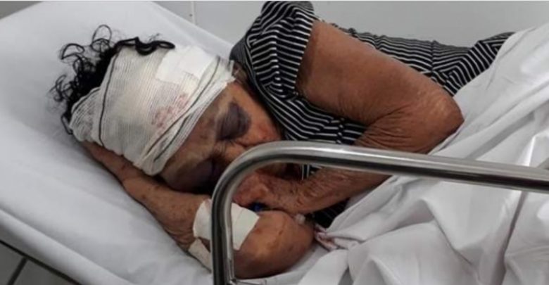 Idosa espancada morre - Foto/Divulgação